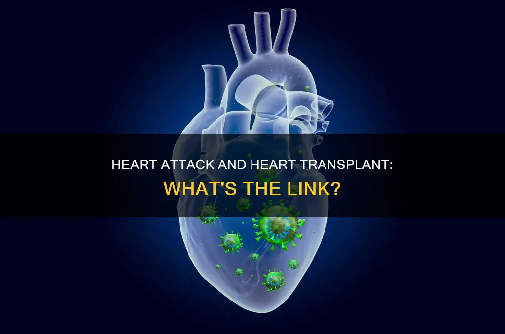 does a heart attack constitute a heart transplant