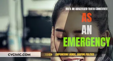 Tooth Abscess: When is Emergency Room Visit Necessary?