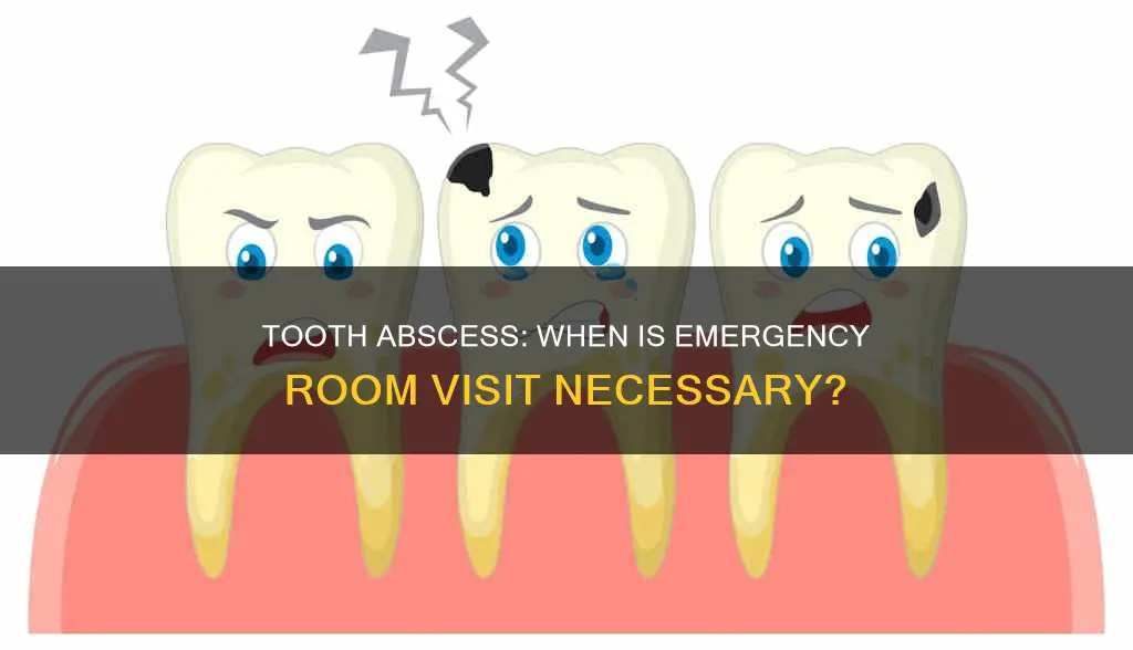 does an abscessed tooth constitute as an emergency