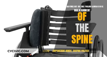 Asymmetry in Folds: A Sign of Spinal Malalignment?