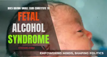 Small Ears and FAS: Is There a Link?