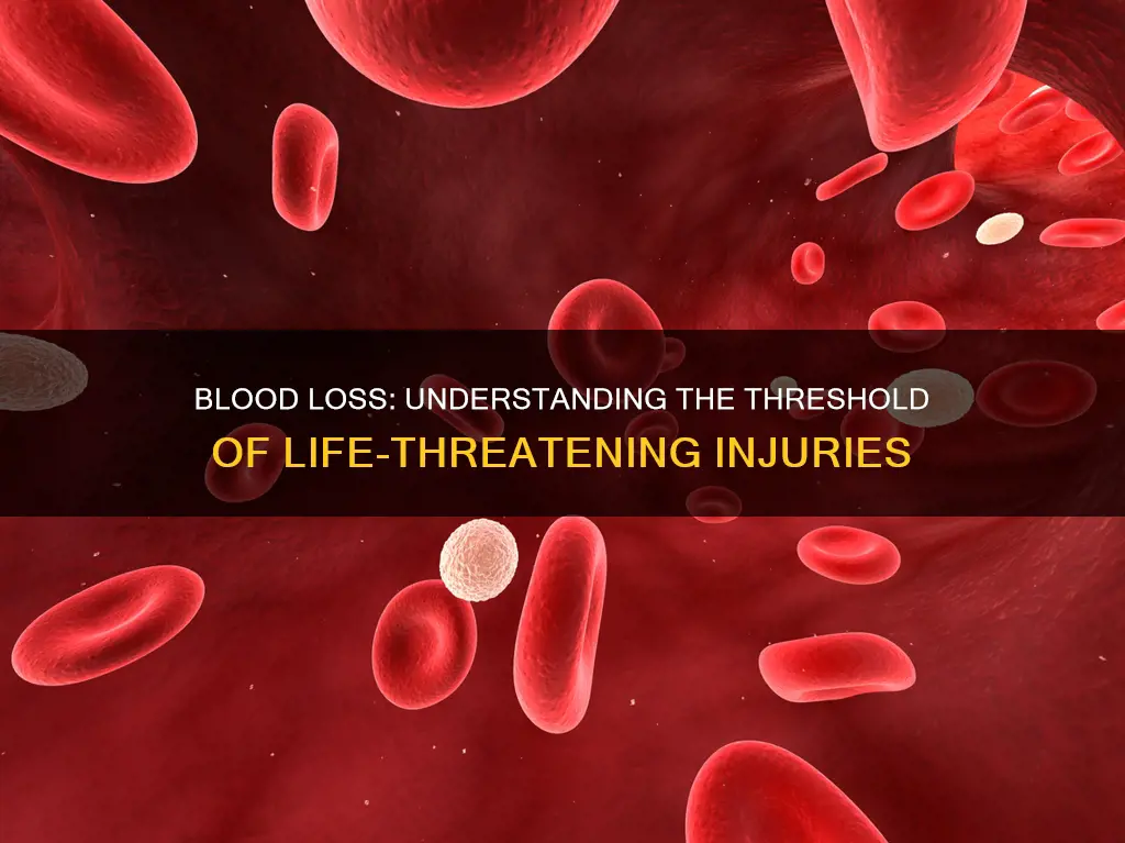 how much blood loss constitutes a life threatening injury