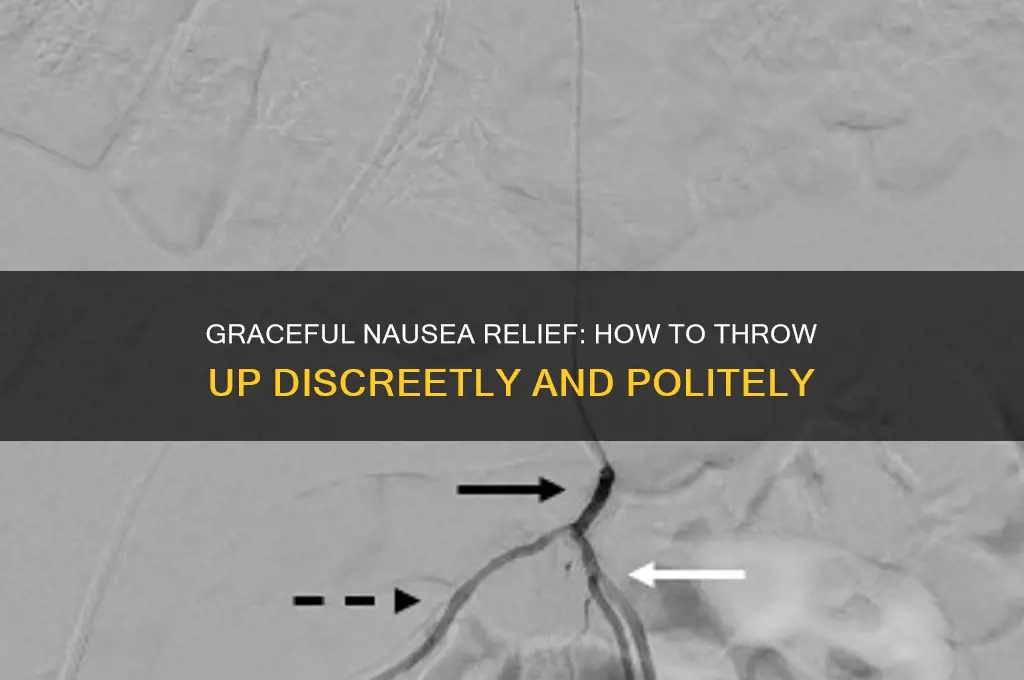 how to throw up politely