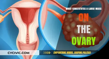 Understanding Ovarian Masses: What Constitutes a Large Ovarian Mass?