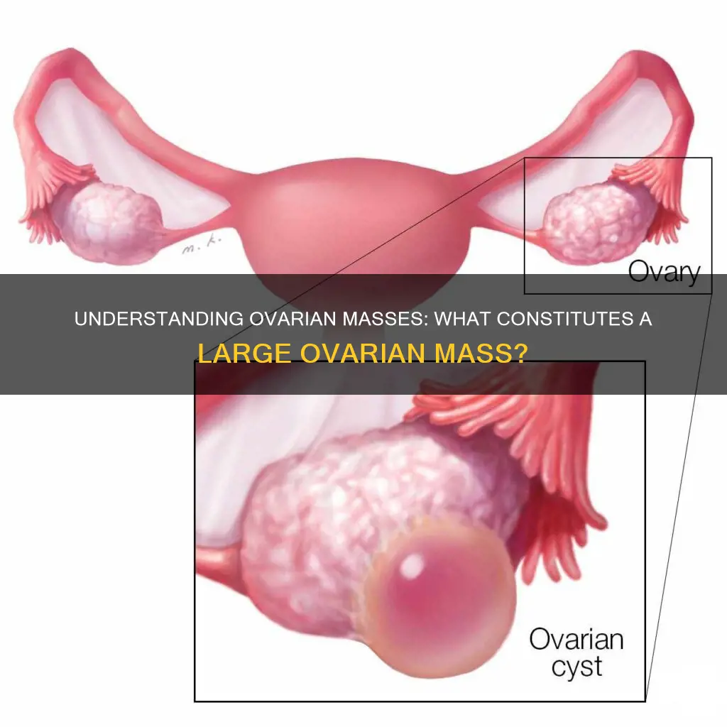 what constitutes a large mass on the ovary