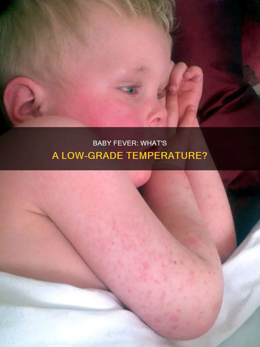 what constitutes a low grade fever in babies