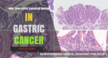 Margin Matters: Gastric Cancer's Negative Impact