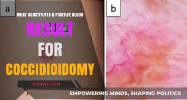 Blood Test Results: Understanding Coccidioidomycosis Positivity