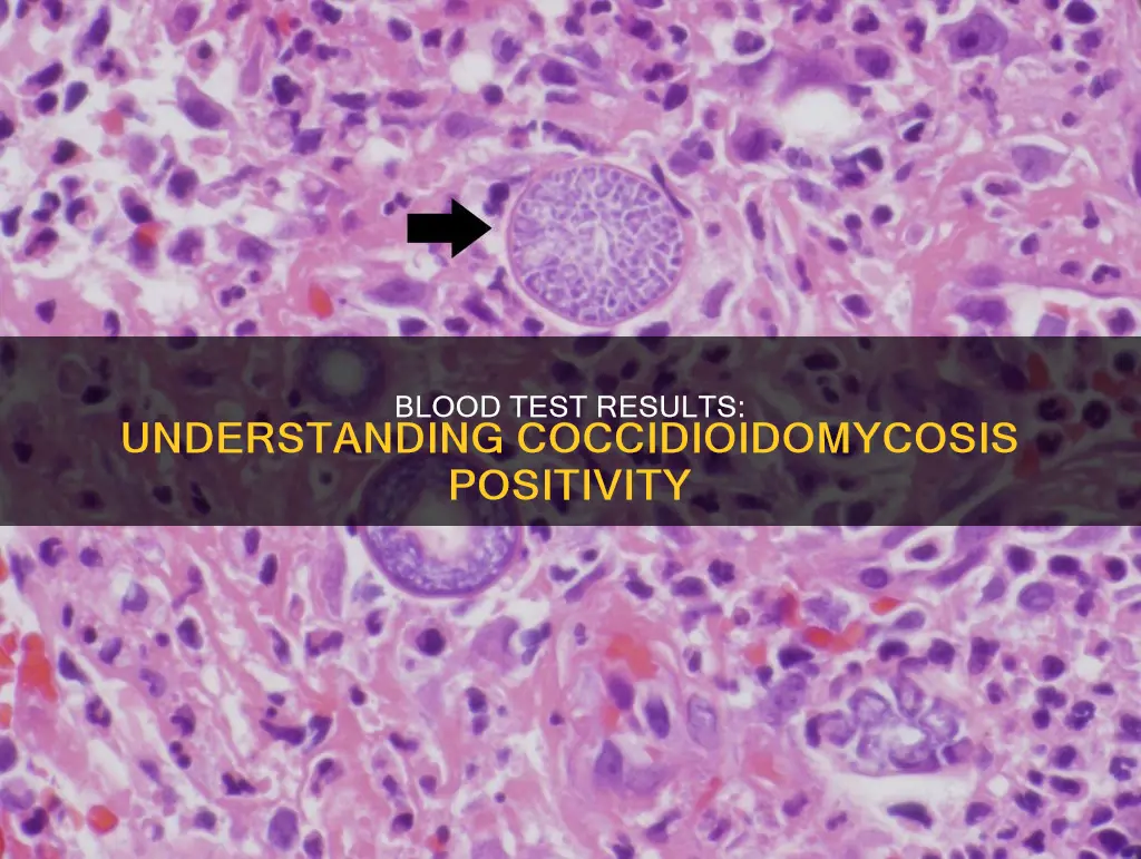 what constitutes a positive blood result for coccidioidomycosis