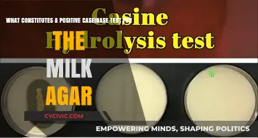 Caseinase Test: Milk Agar Positive Results Explained