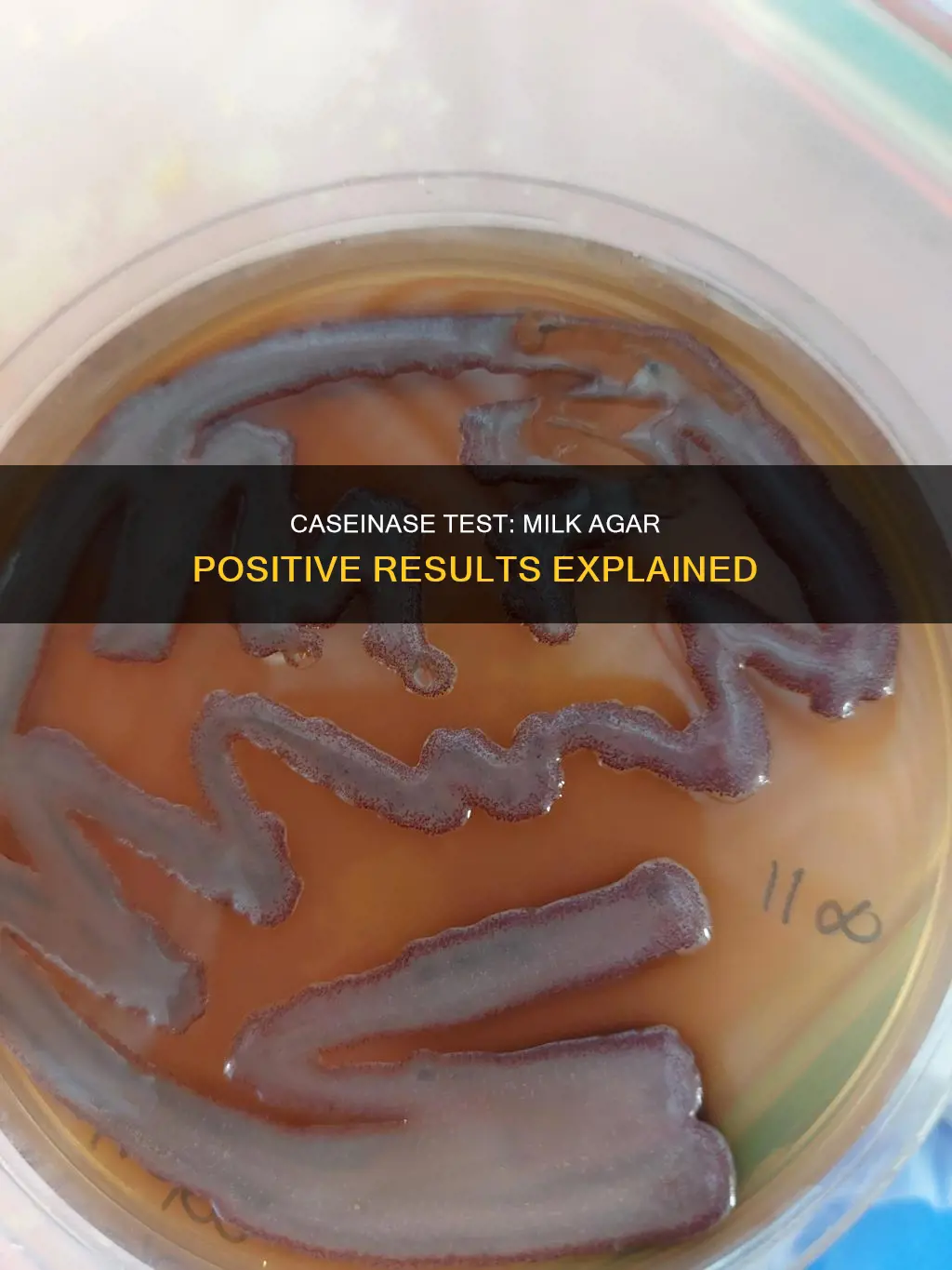 what constitutes a positive caseinase test for the milk agar