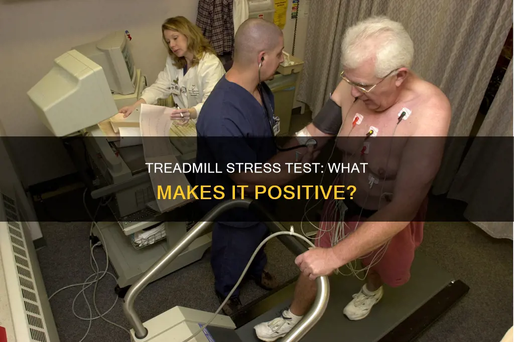 what constitutes a positive exercise treadmill stress test