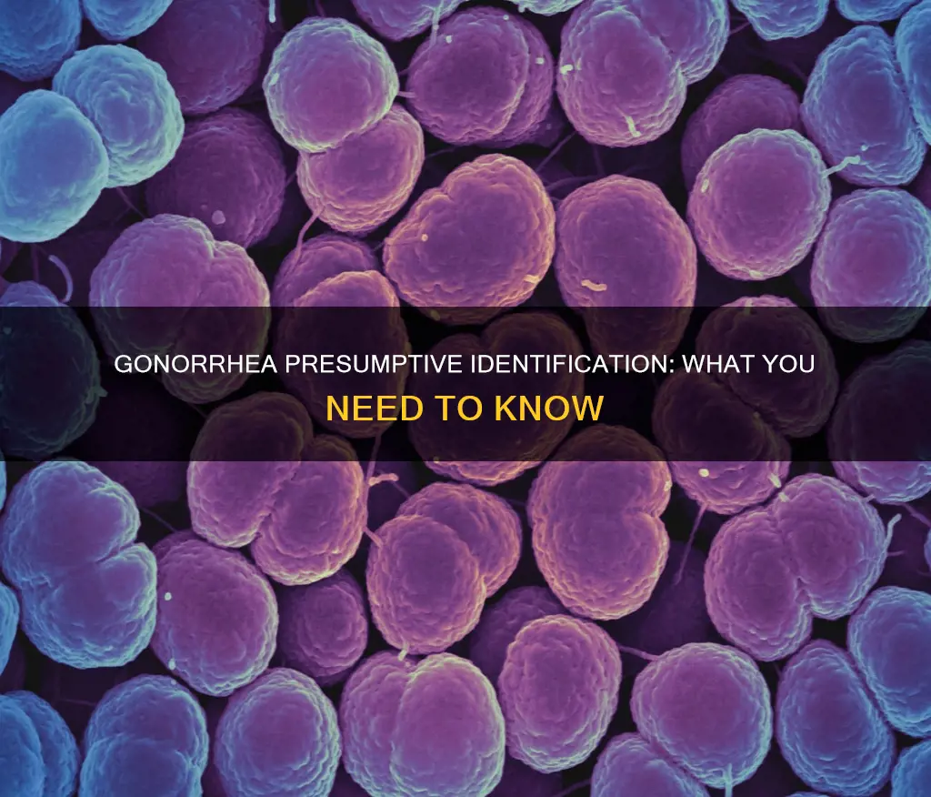 what constitutes a presumptive identification of n gonorrhoeae