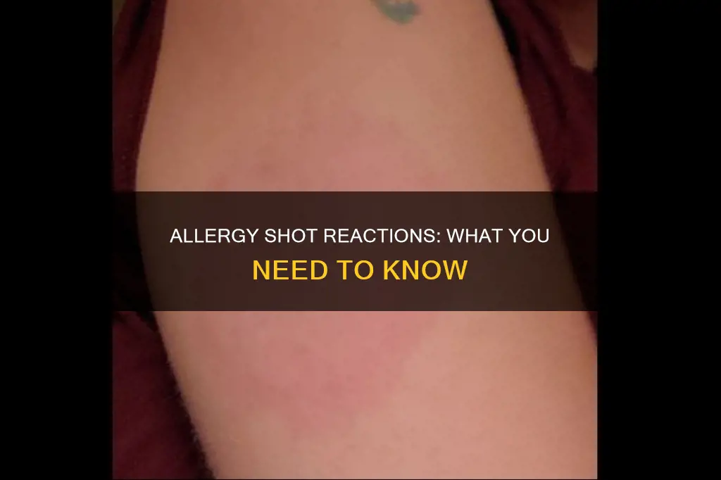 what constitutes a reaction to an allergy shot
