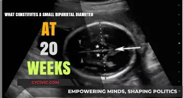Understanding Small Biparietal Diameter at 20-Week Scan