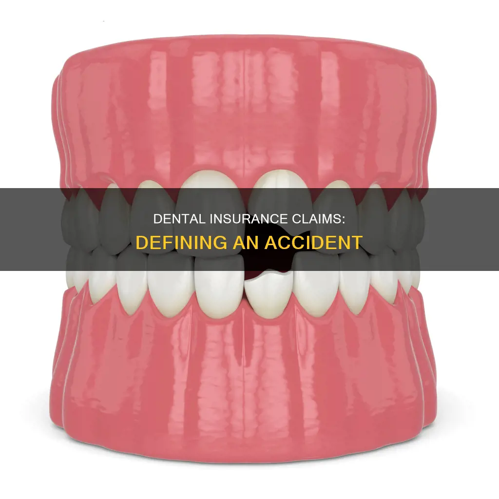 what constitutes an accident for dental insurance claim