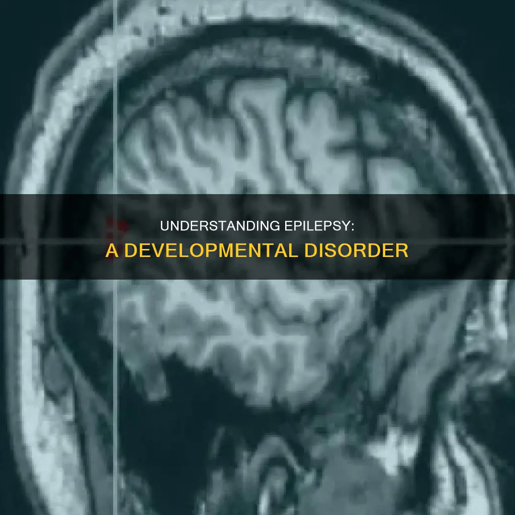 what constitutes epilepsy to be a developmental disorder