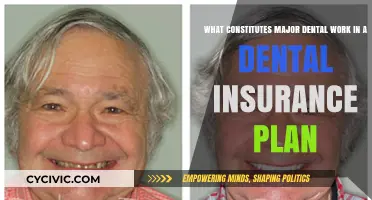 Dental Insurance: Understanding Major Dental Work Coverage