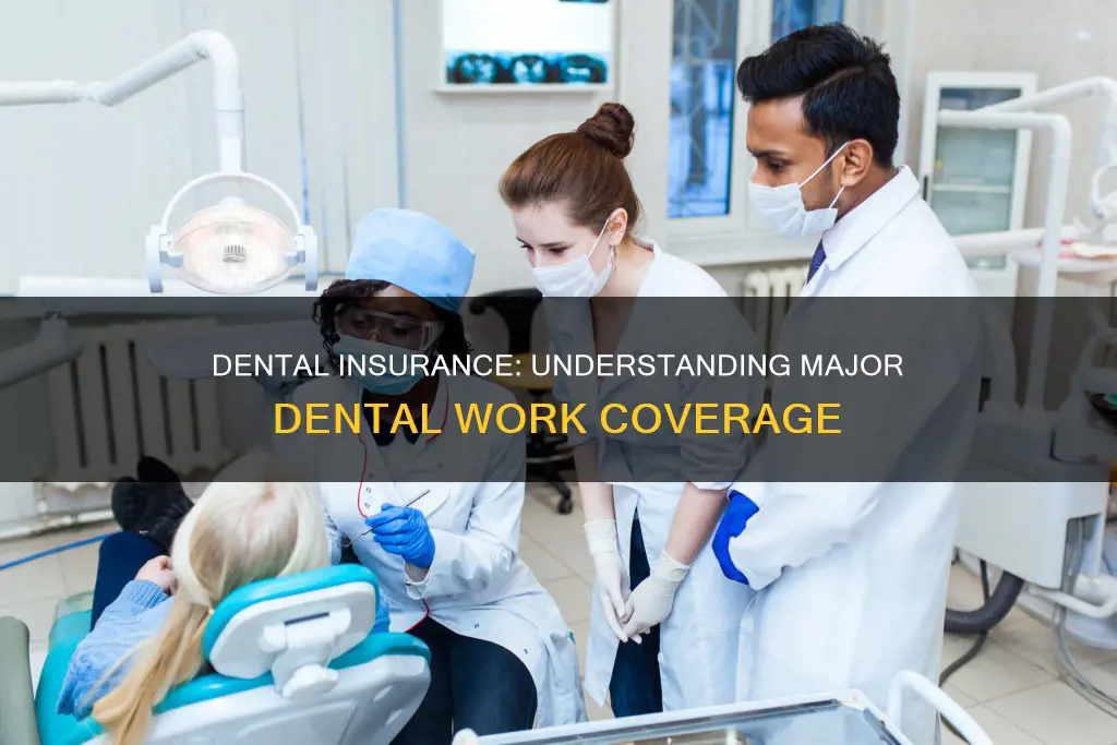 what constitutes major dental work in a dental insurance plan