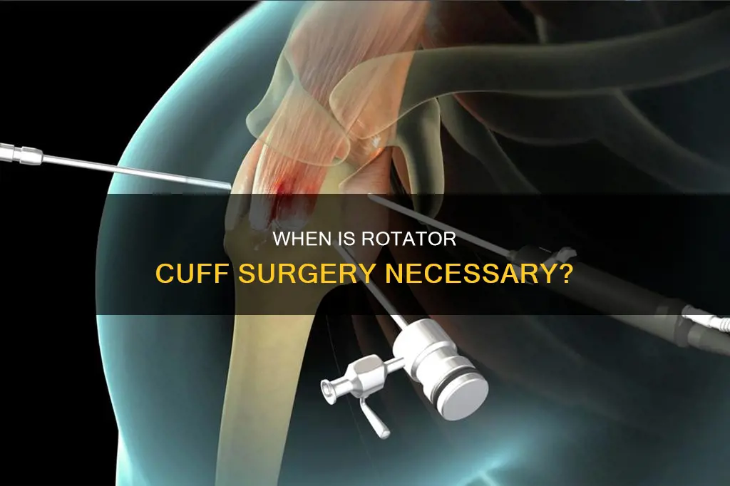 what constitutes the need for rotator cuff surgery