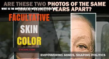 Facultative vs. Constitutive Skin Color: Understanding the Difference