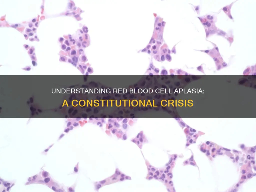 what is the name of constitutional red blood cell aplasia