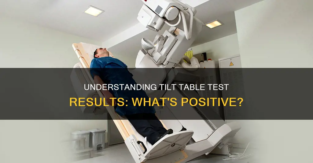 what medically constitutes a positive tilt table test