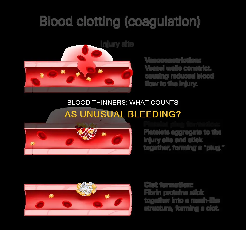 when on blood thinners what constitutes unusual bleeding
