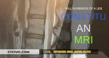 Leg Numbness: When an MRI is Necessary